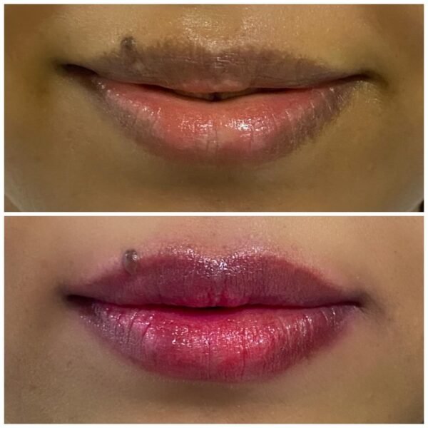 Lip micropigmentation – Face Spa by Sana Khan